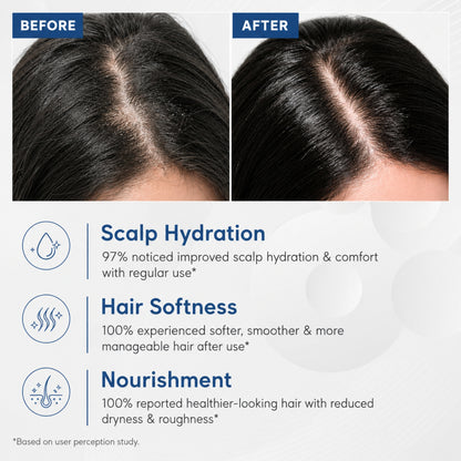 Complete Scalp Health - Deep Conditioning and Nourishment
