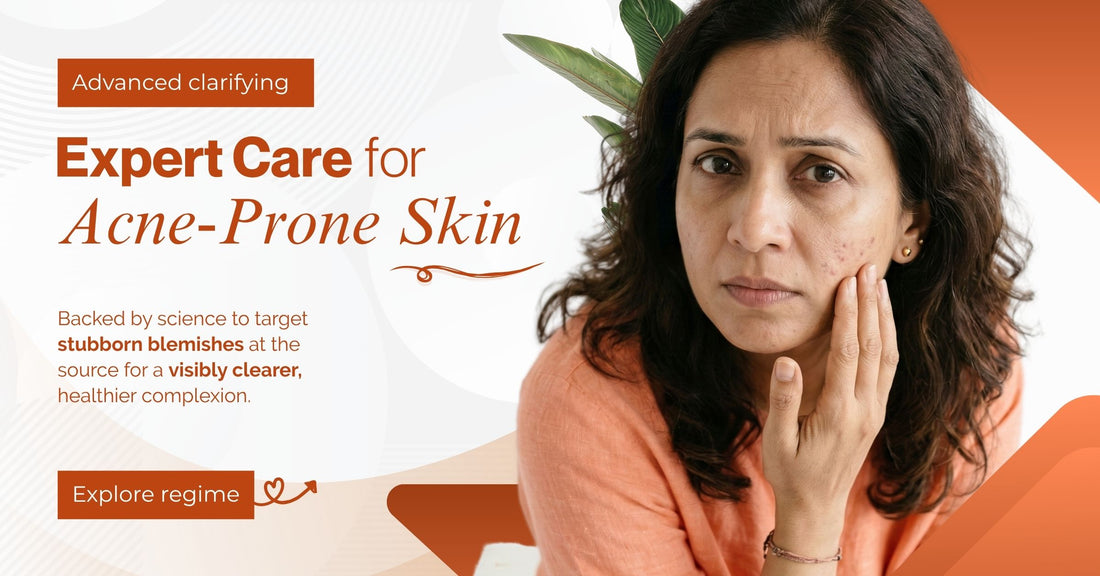 DEEP ACNE – The Skin Story