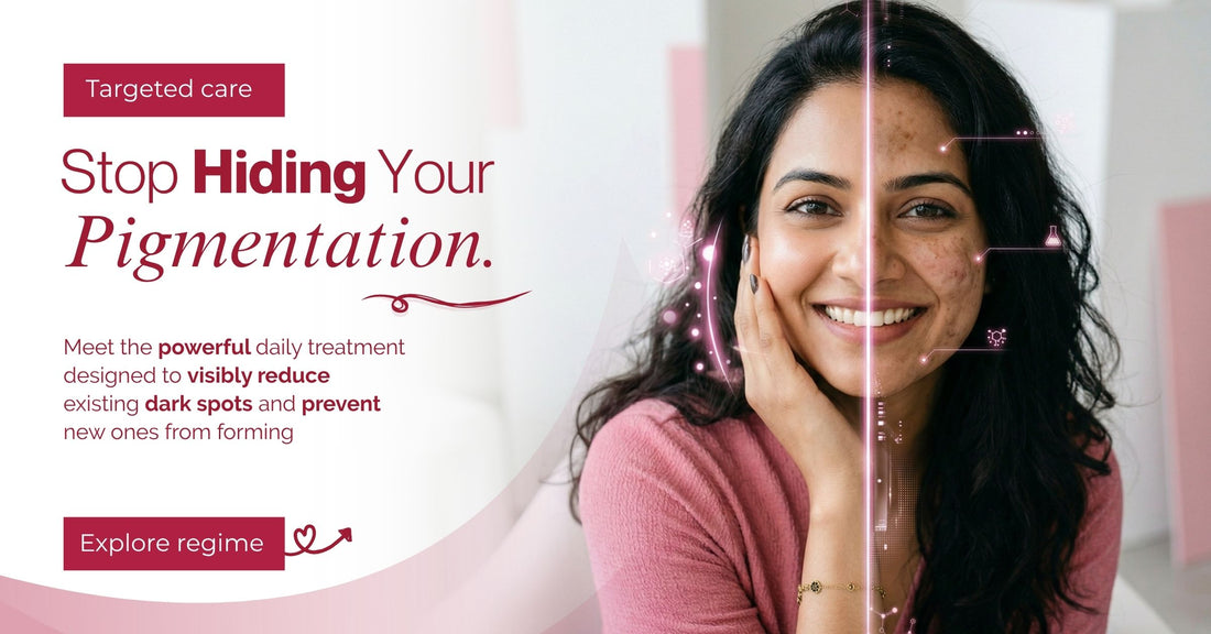 EARLY ONSET PIGMENTATION – The Skin Story