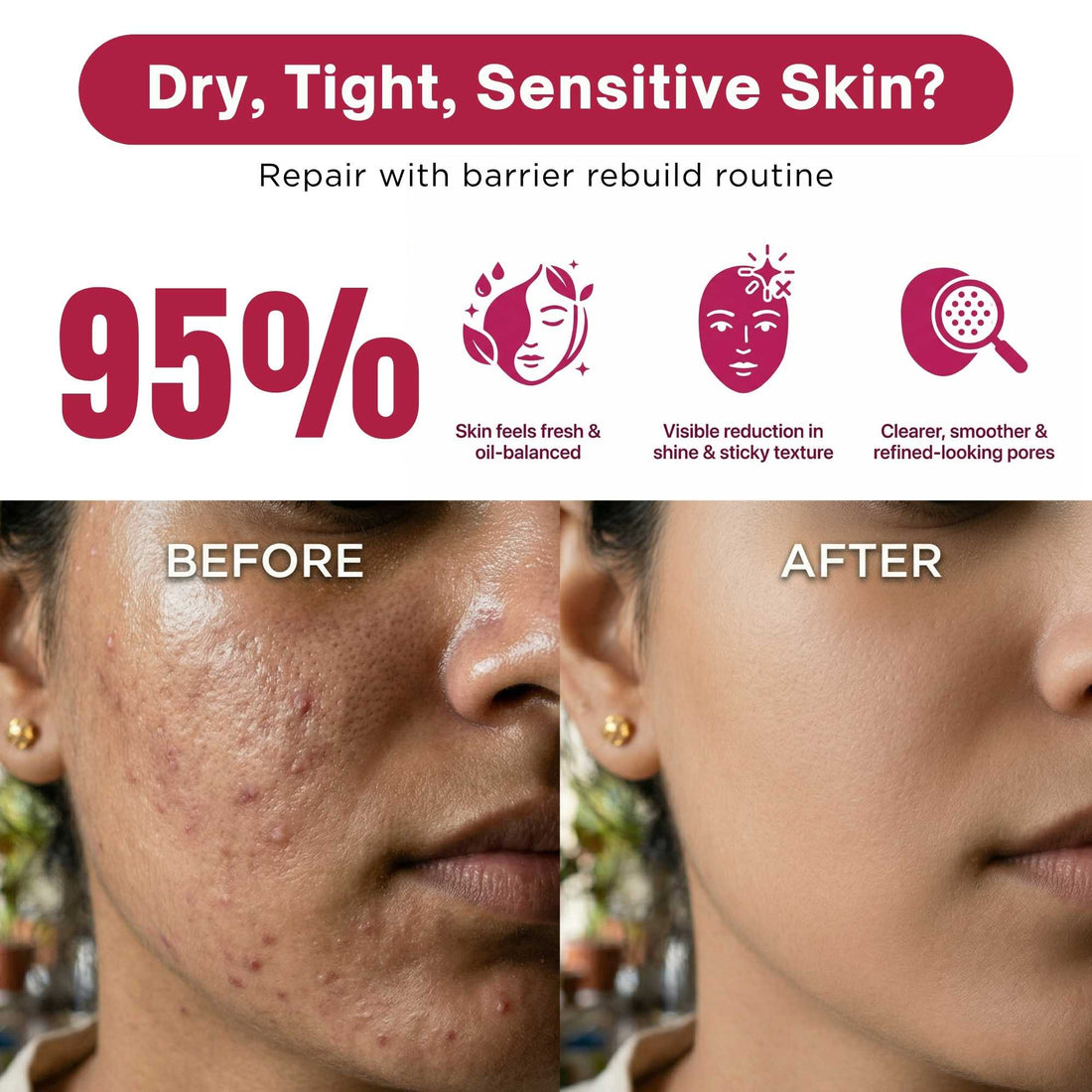Oil Control Protect Regime – Shine Control &amp; SPF Defense