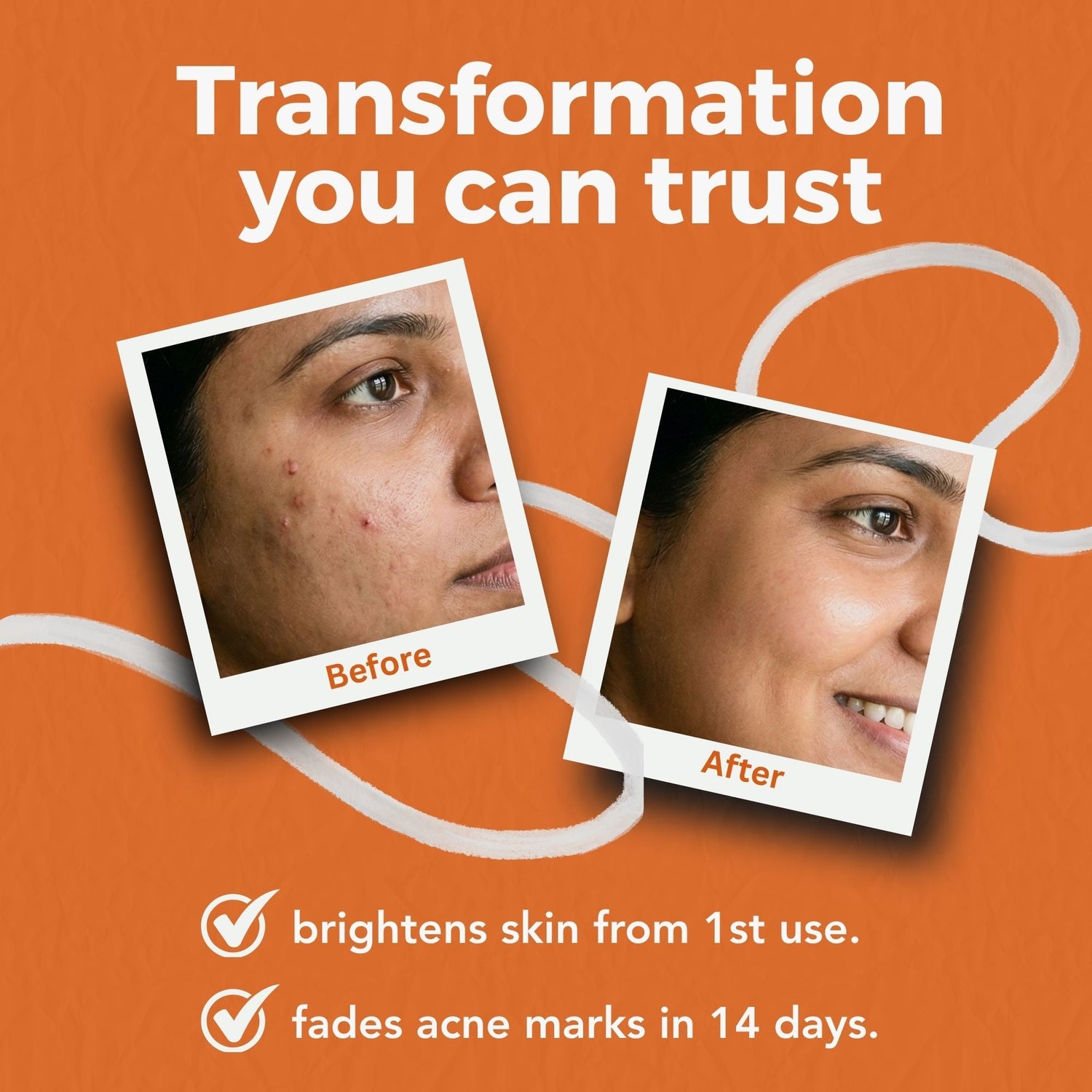 Acne Clearing Serum Duo - The Skin Story - 