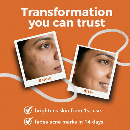 Acne Clearing Serum Duo - The Skin Story - 