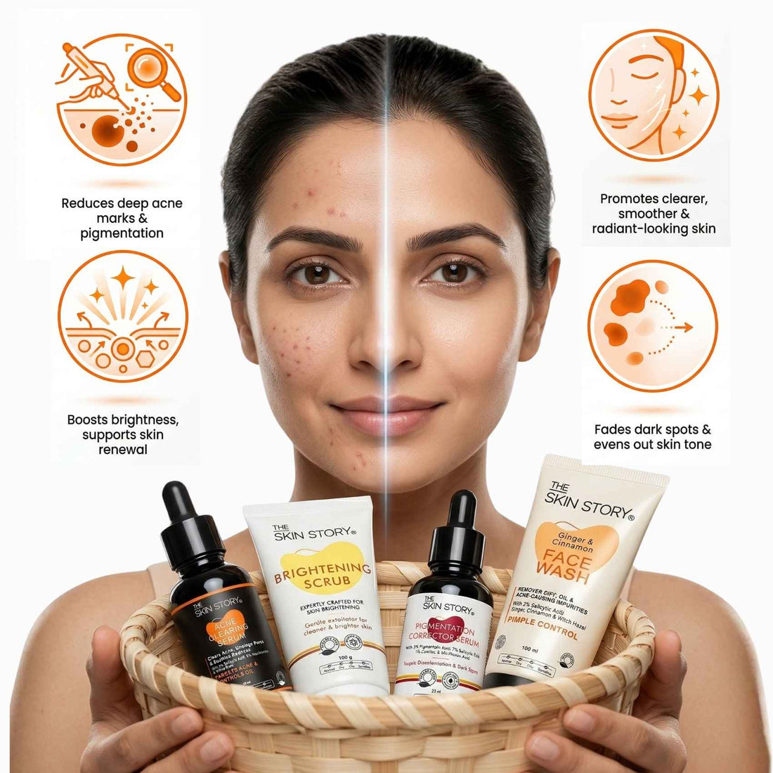 Acne Pigmentation Repair Regime – Deep Spot Correction Routine - The Skin Story - 