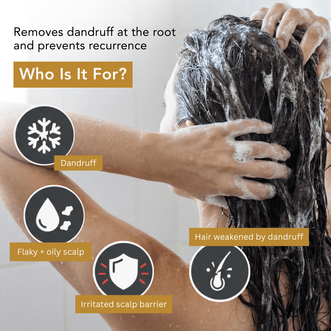 Anti - Dandruff Shampoo - The Skin Story - shampoo