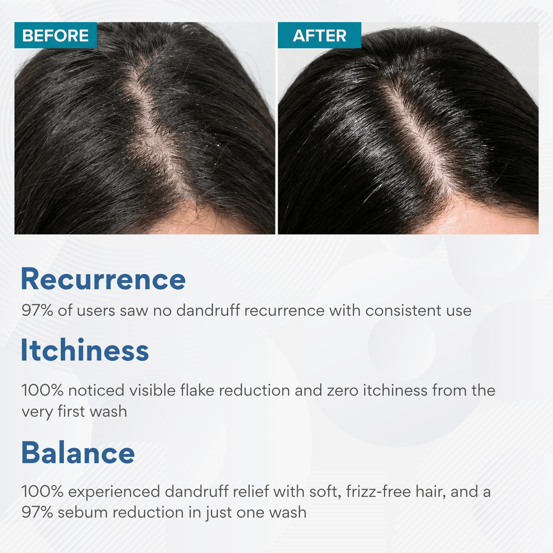 Anti - Dandruff Shampoo - The Skin Story - shampoo