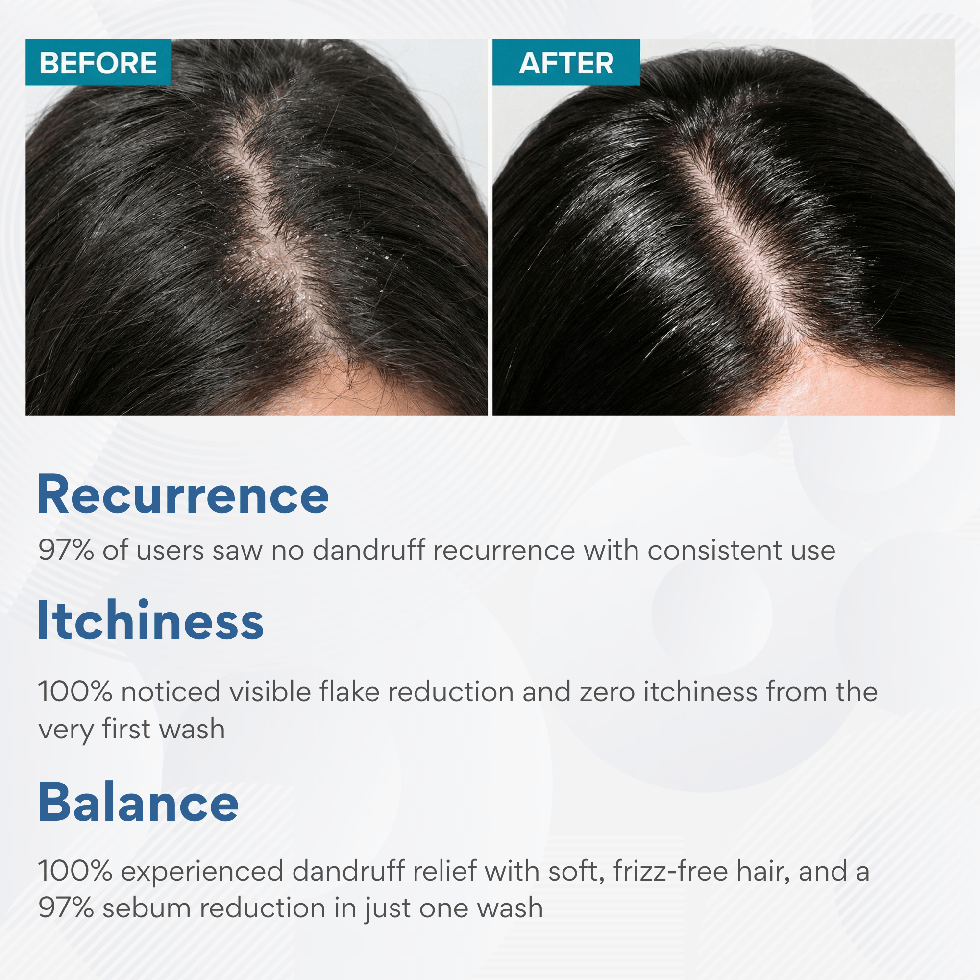 Anti - Dandruff Shampoo - The Skin Story - shampoo