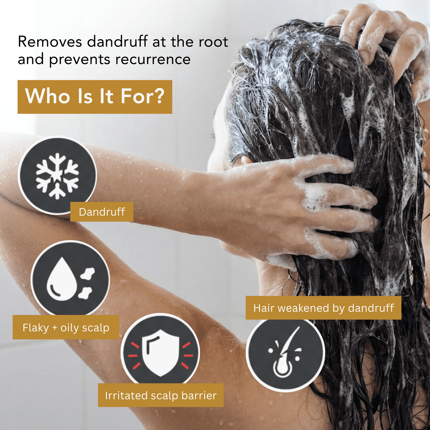 Anti - Dandruff Shampoo - The Skin Story - shampoo