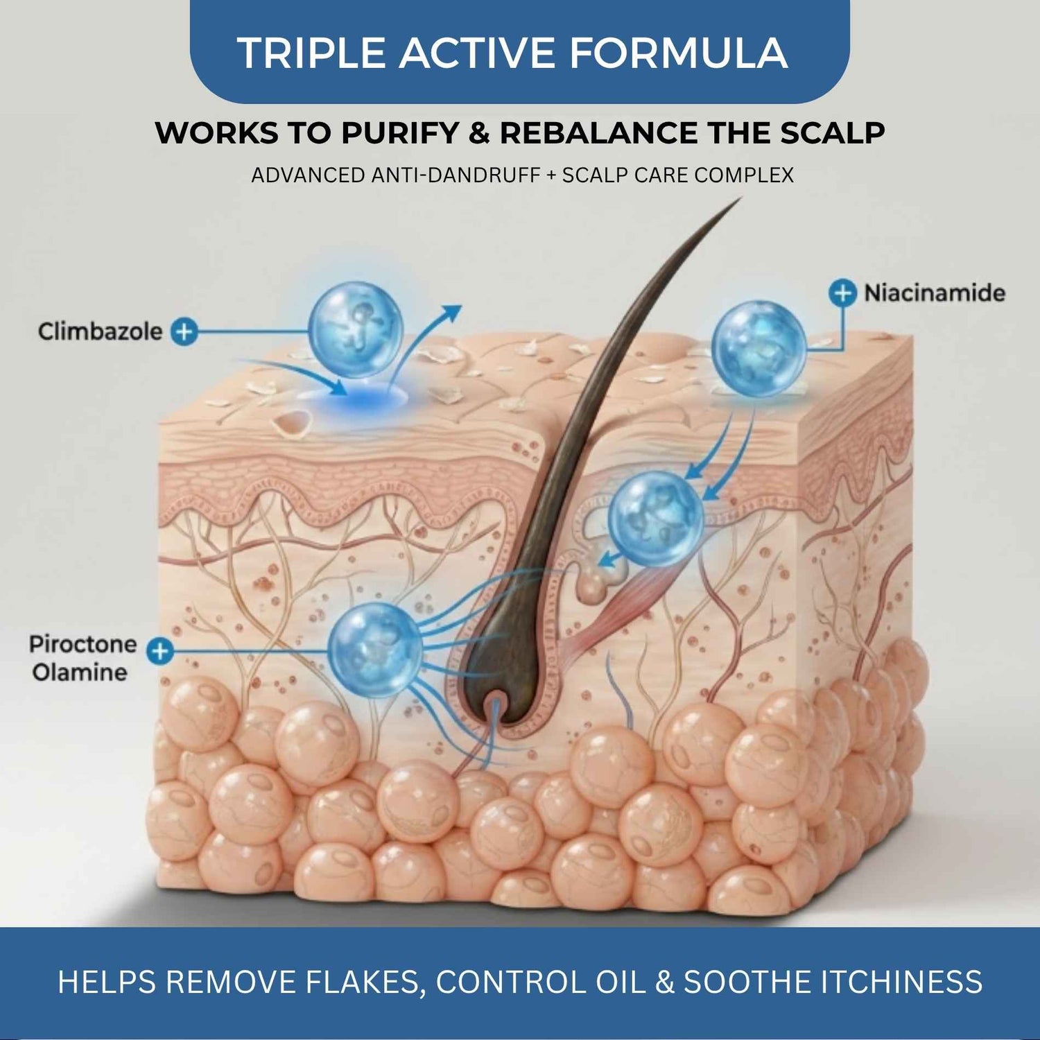 Dandruff - 3 steps - Shampoo+Exfoliating Scalp Serum+Hair Mask - The Skin Story - 