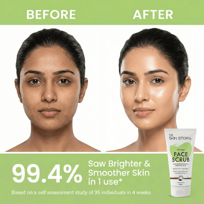 De - Tan &amp; Blackhead Face Scrub - The Skin Story - Scrub