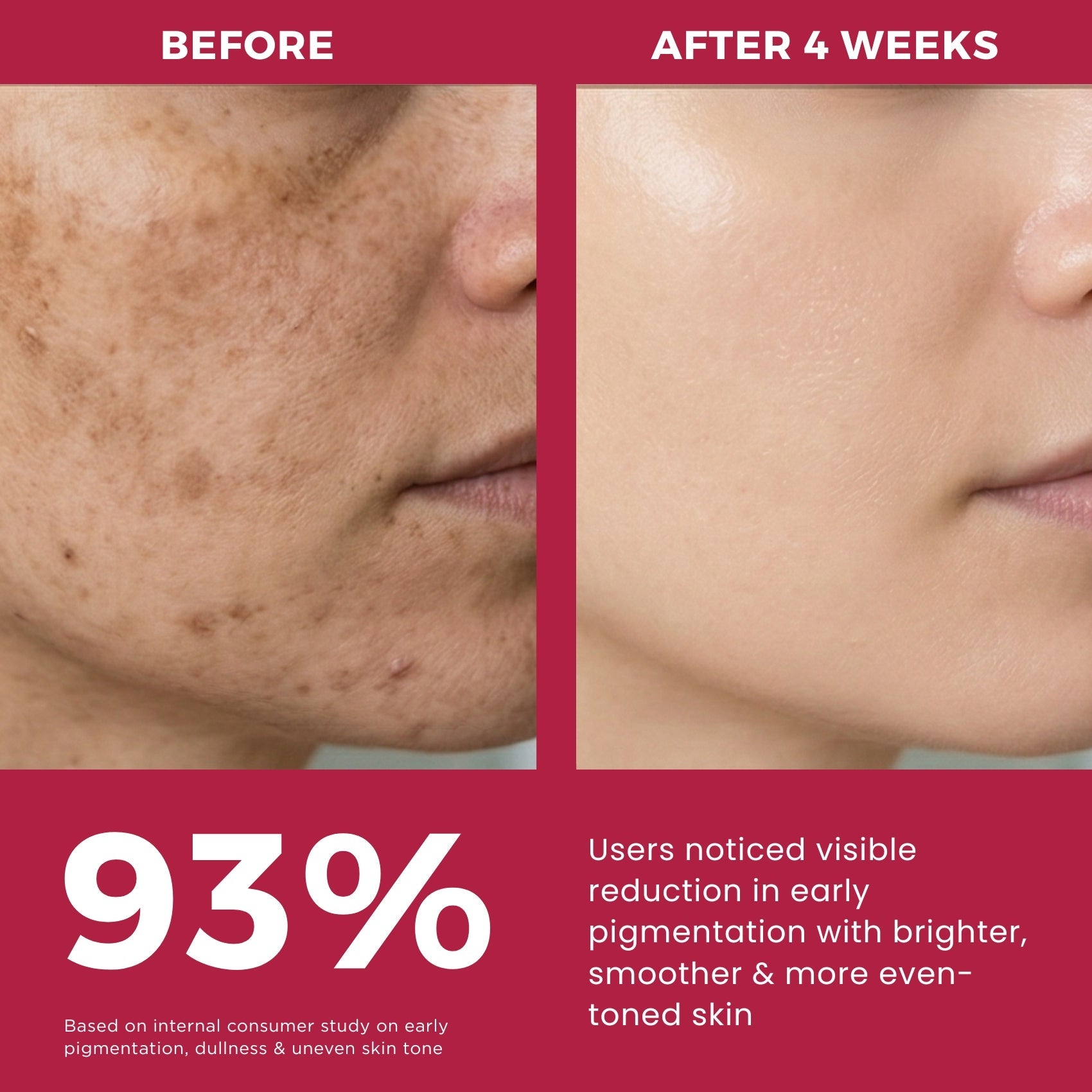 Dull &amp; Uneven Skin Tone - 2 Step with Facewash+10% Vitamin C Face Serum - The Skin Story - 