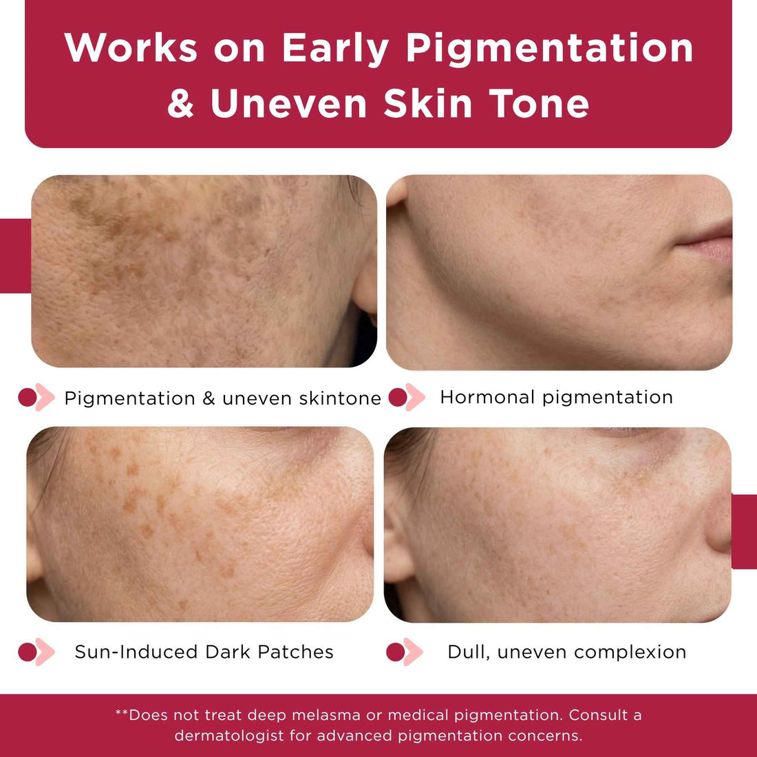 Dull &amp; Uneven Skin Tone - 3 Step with Facewash+10% Vitamin C Face Serum+Sunscreen SPF50 - The Skin Story - 