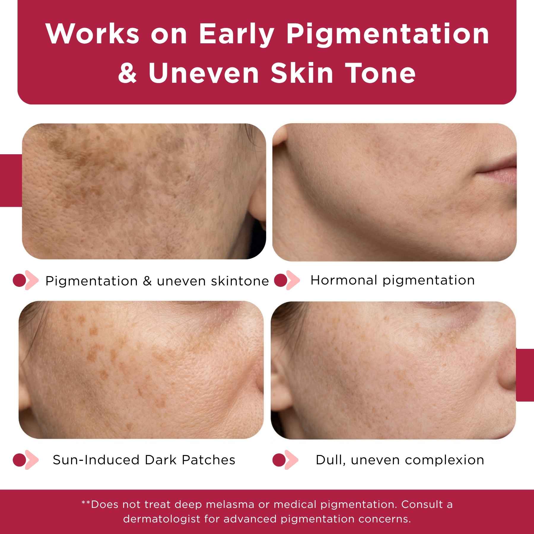 Dull &amp; Uneven Skin Tone - 3 Step with Facewash+10% Vitamin C Face Serum+Sunscreen SPF50 - The Skin Story - 