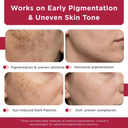 Dull &amp; Uneven Skin Tone - 3 Step with Facewash+10% Vitamin C Face Serum+Sunscreen SPF50 - The Skin Story - 