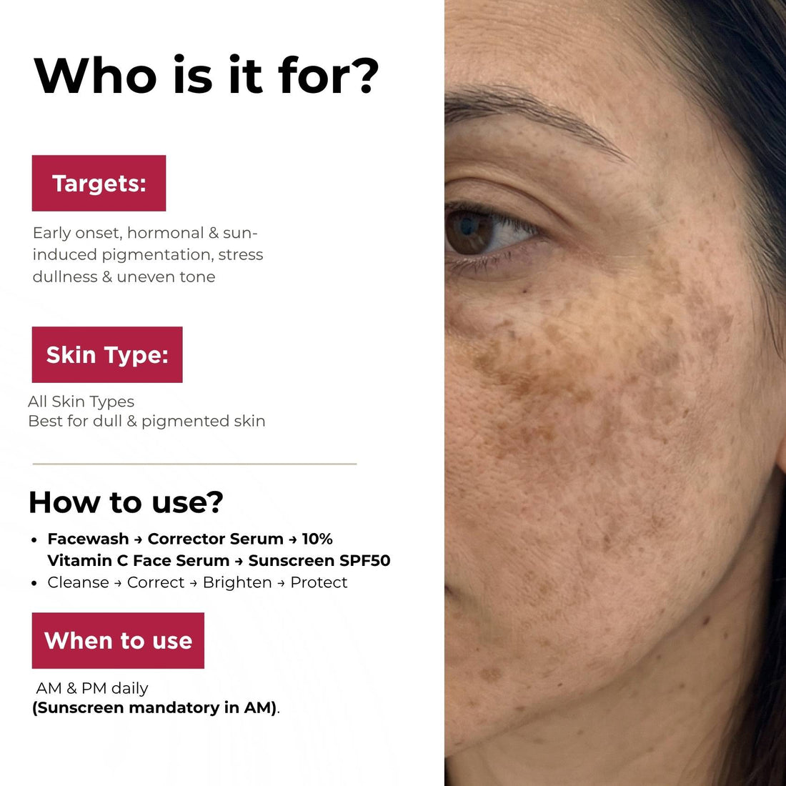 Early Onset Pigmentation 4 steps - Facewash+Corrector Serum+10% Vitamin Serum+Sunscreen SPF50 - The Skin Story - 