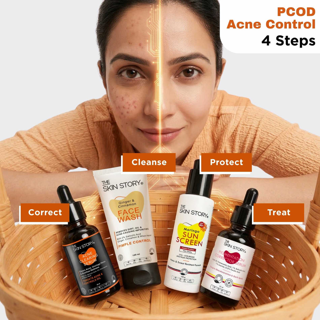 Hormonal Acne Reset Regime – PCOD Acne Balance Routine - The Skin Story - 