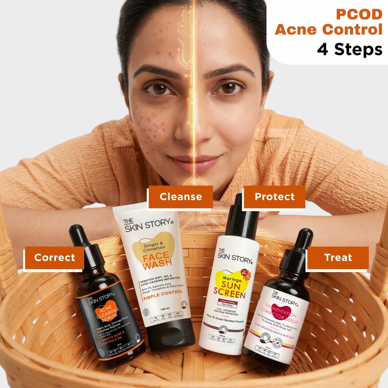 Hormonal Acne Reset Regime – PCOD Acne Balance Routine - The Skin Story - 