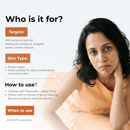 Mild Acne Starter Regime 3 steps Ginger Cinnamom Facewash Toner Acne Clearing Serum Mild Acne 3 - Step Starter Routine with Toner - The Skin Story - 