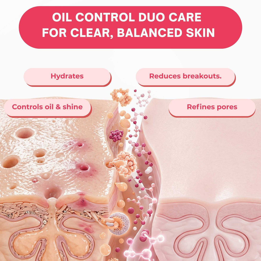 Oil Control 2 Steps - Facewash+Oil Free Moisturiser - The Skin Story - 