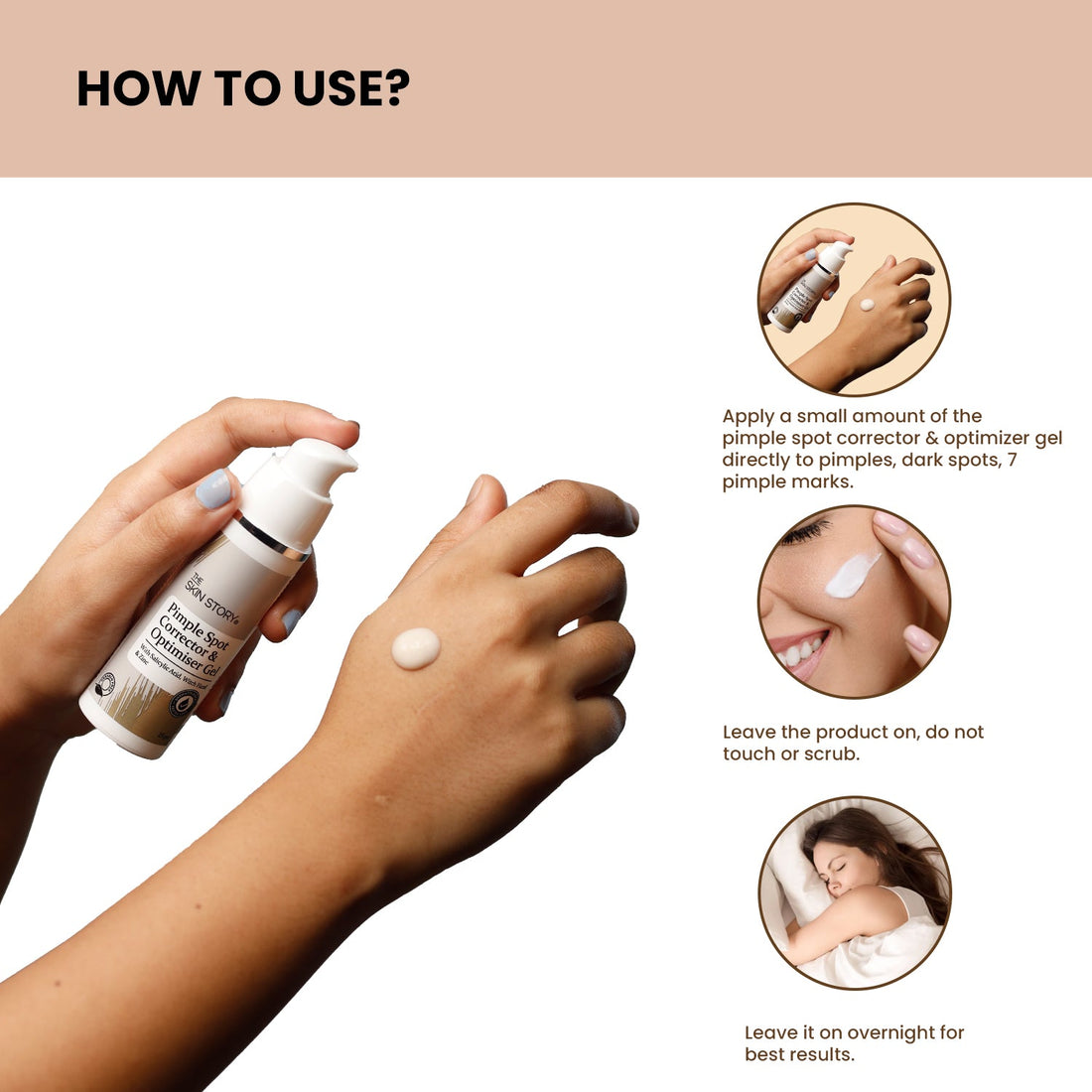 Pimple &amp; Acne Corrector Gel - The Skin Story - 