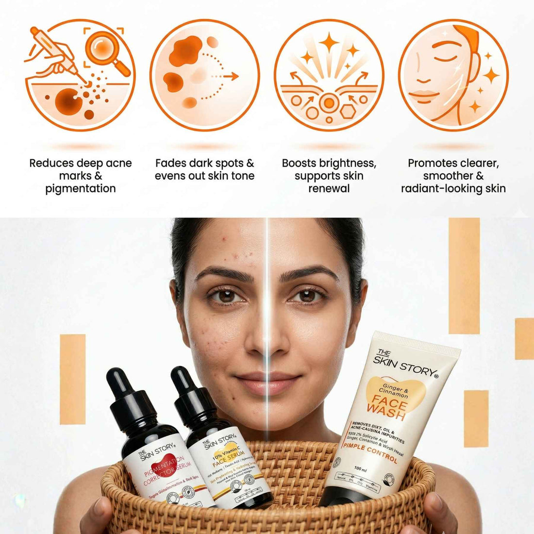 Pimple Spot Repair Regime – Acne Marks Treatment Routine - The Skin Story - 