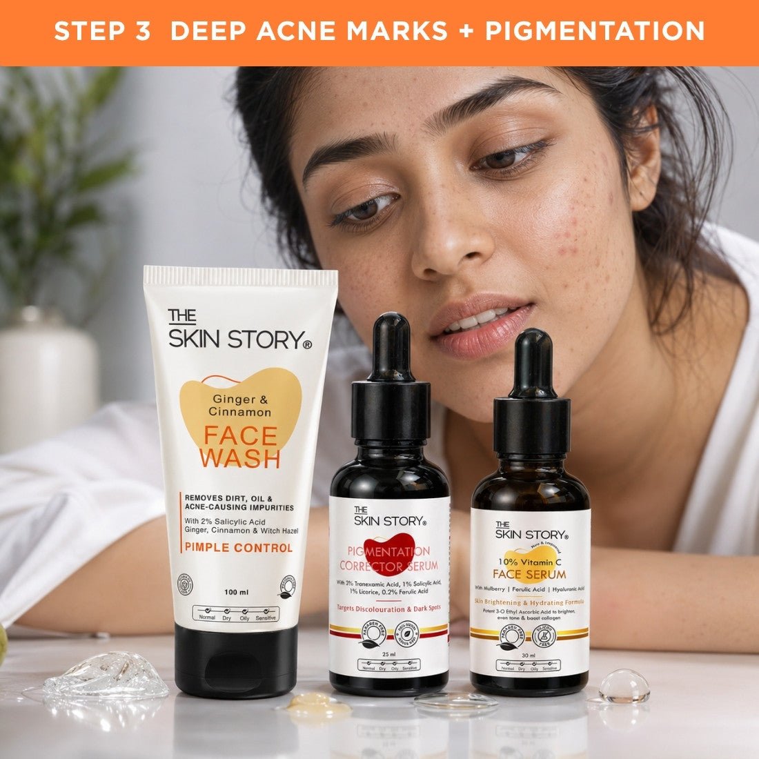 Pimple Spot Repair Regime – Acne Marks Treatment Routine - The Skin Story - 