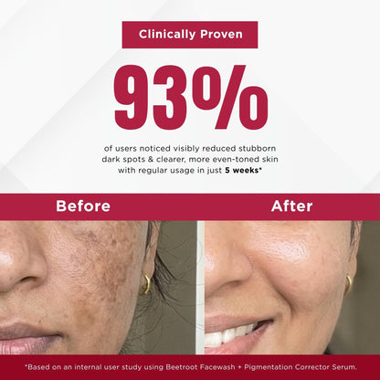 Stuborn Dark Spots 2 Steps - Facewash+Serum - The Skin Story - 