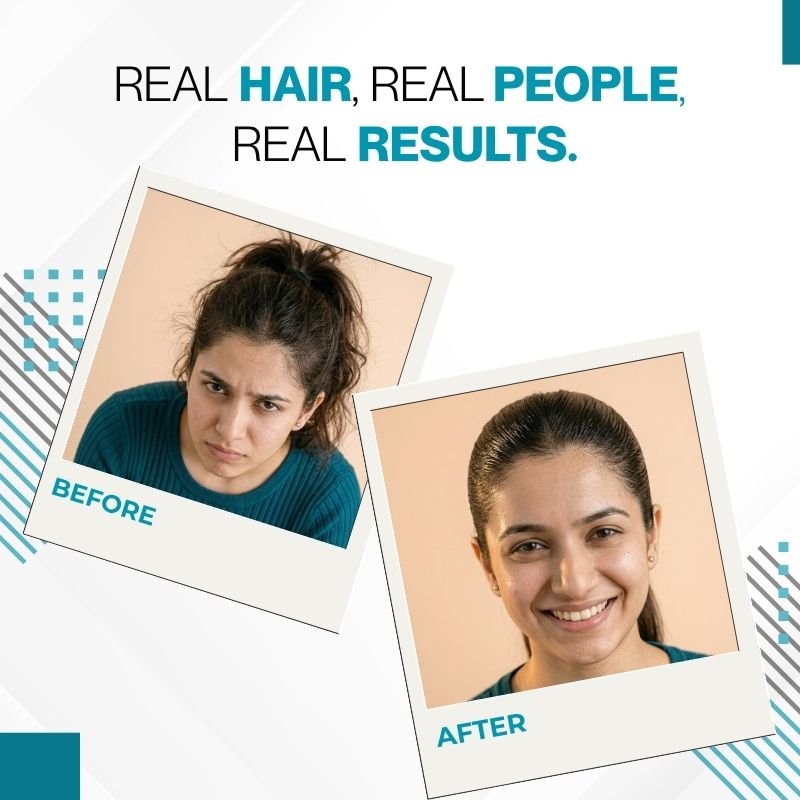 The Skin Story Hair Fix Stick - The Skin Story - 