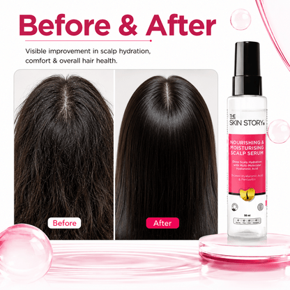 The Skin Story Nourishing and Moisturising Scalp Serum, 50ml - The Skin Story - Hair Serum